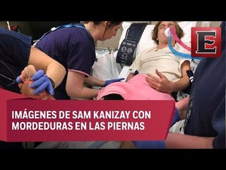 Piojos 'carnívoros' atacan a joven en playa de Australia