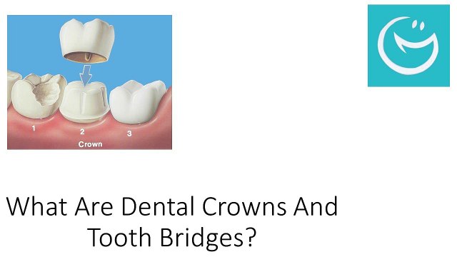 What Are Dental Crowns And Tooth Bridges