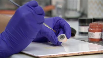 هذا الصباح-تقنية جديدة لحل مشكلة تشوهات العيون