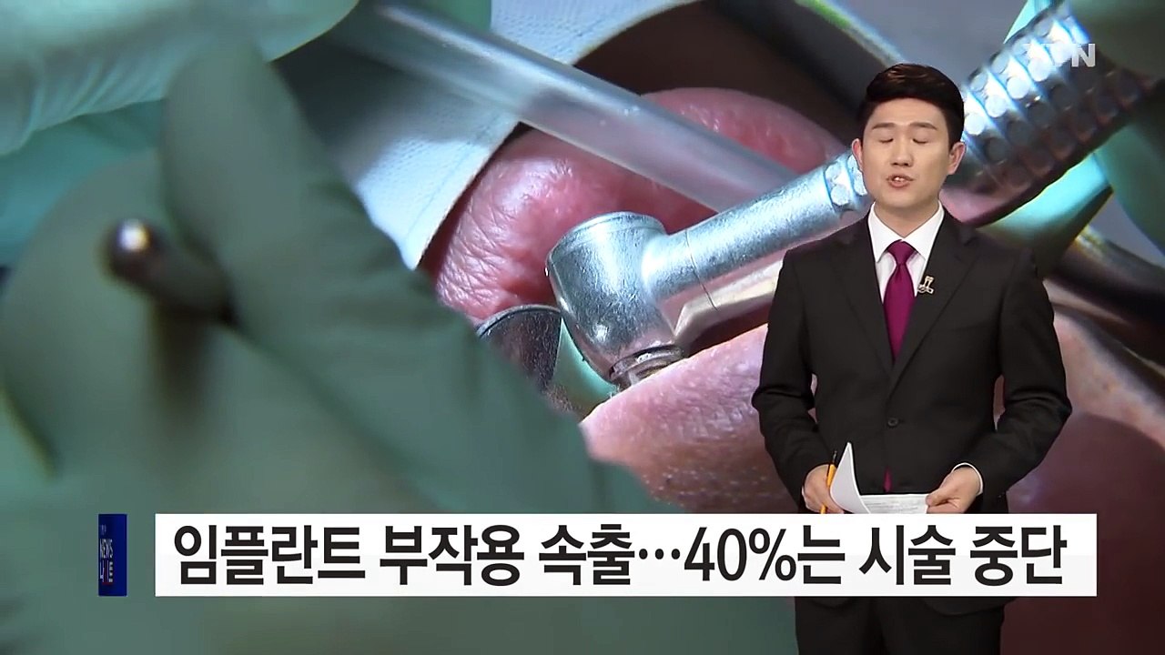 "임플란트 부작용 속출...40%는 시술 중단" / YTN (Yes! Top News)
