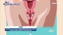 이쁜이 수술(질 성형수술) 하면 정말.. 좋을까?