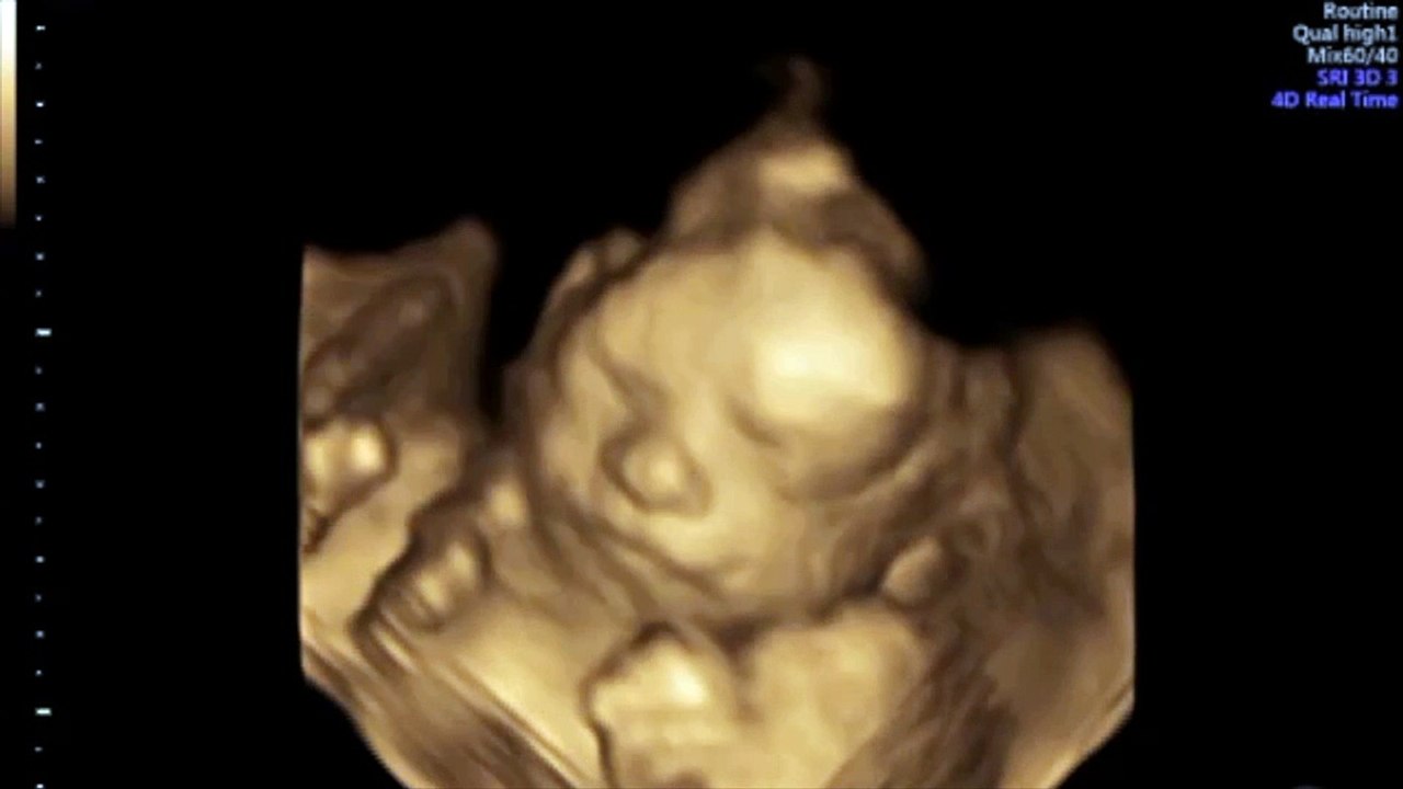 Leonardo in arrivo.