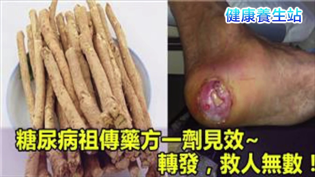 糖尿病祖傳藥方一劑就見效，一定要轉發，可救人無數……