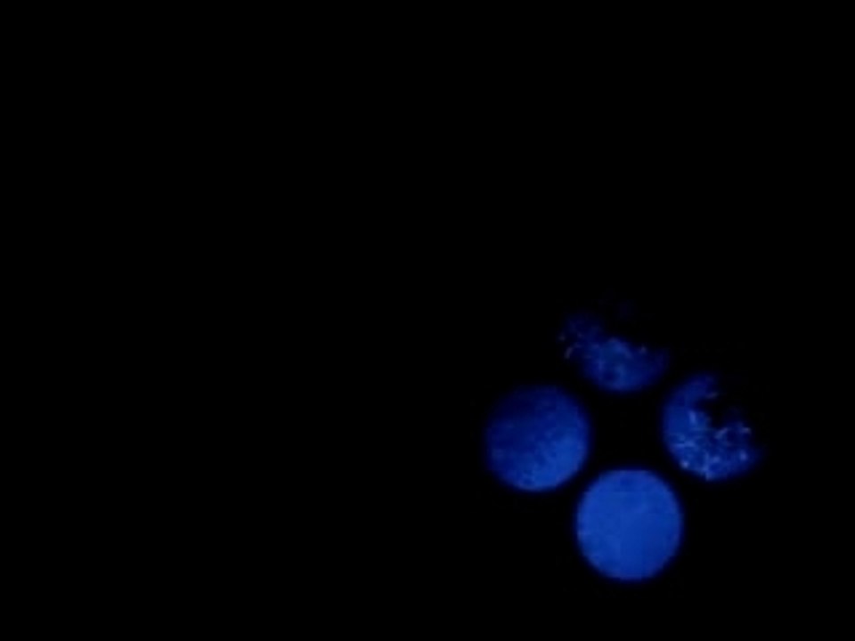 Scan 260 Balayage dans la cours