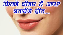 Lips tell about health problems | कितने बीमार हैं आप, बतायेंगे होंठ | Boldsky