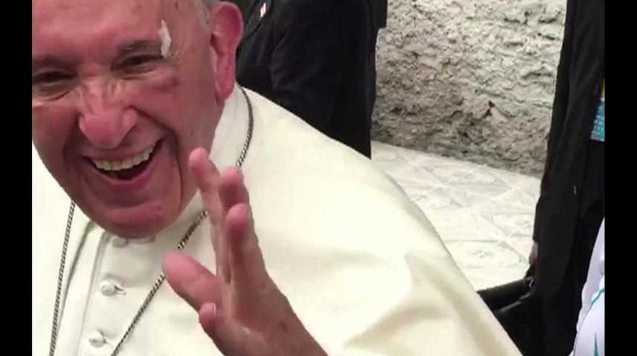 Accident de Papamobile : le Pape François, blessé, garde le sens de l'humour