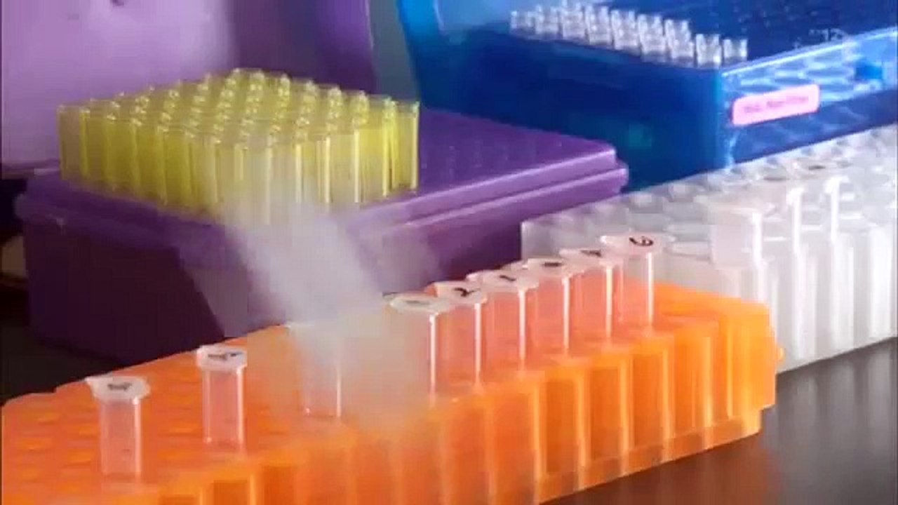 がんリスク評価とは・・・？尿を検査する事でガンになるリスクを知る！会員制メディカルクラブ（まもーる）