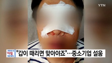 [단독] "갑이 때리면 맞아야죠"...폭행 견뎌야 하는 중소기업 설움 / YTN