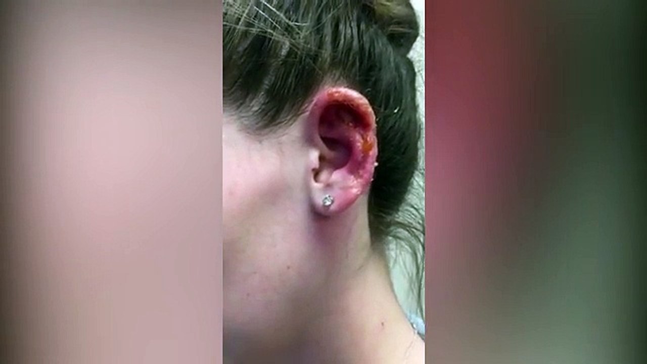 This Is The Truly Nasty Thing That Can Happen If You Get This Piercing