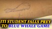 Blue Whale Challenge : ITI student admitted for allegedly playing online game | Oneindia News