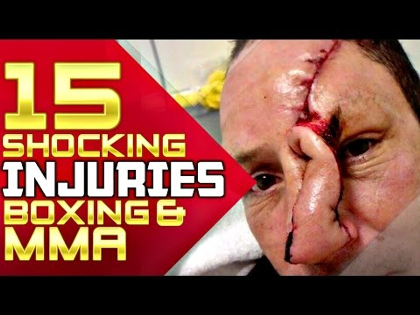 Mma Injuries