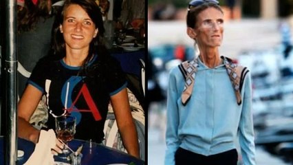 इस लड़की के बारे में जानकर आपकी रूह काँप उठेगी | Valeria Levitin Thinnest Woman In the World