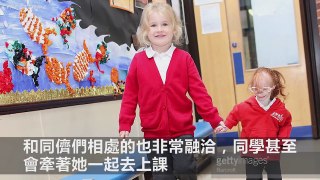 她是全球最小「只有68公分」拇指姑娘，醫生說她活不到1歲，但她上小學後竟然「發生了奇蹟」！