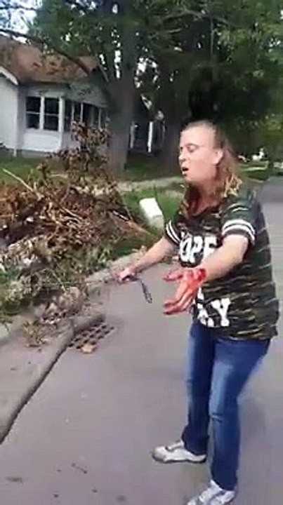 Un pitbull sauve sa maitresse d'une attaque d'un autre pitbull !