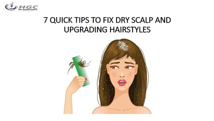 7 QUICK TIPS TO FIX DRY SCALP AND UPGRADING HAIRSTYLES