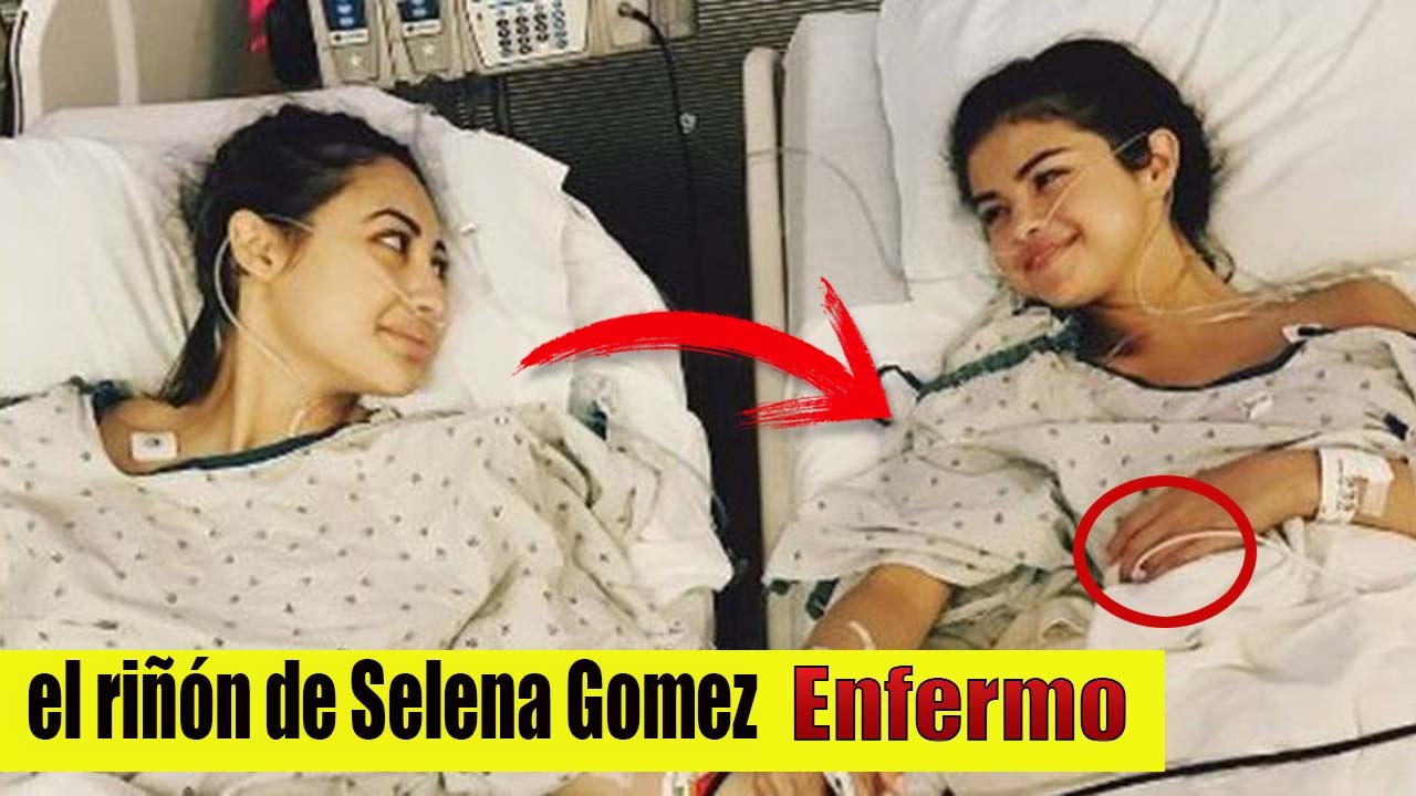 Lupus, la enfermedad que atacó el riñón de Selena Gomez