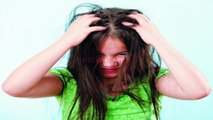How to Get Rid of Head Lice Fast Naturally|| Best Home Remedies for Removing of Lice from Hair