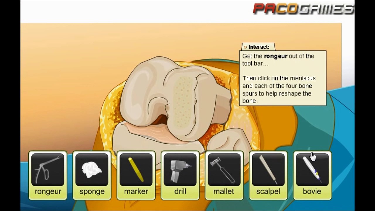 Virtual Knee Surgery - illustrative video