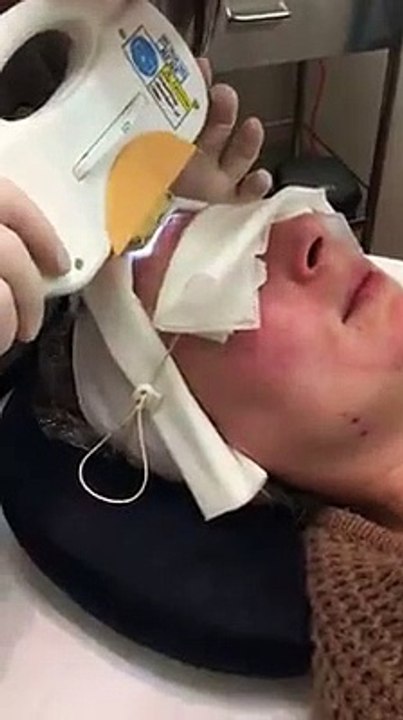 IPL Treatments | Permanent Hair Removal Melton