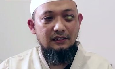 Ada Jenderal Terlibat dalam Penyiraman Air Keras