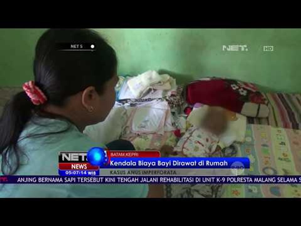 Bayi tanpa Anus - NET5