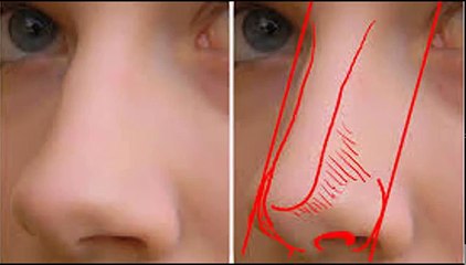 Naak ki barhti hui Haddi ka ilaj sirf 7 Din mein