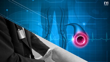 The New Solution to Treating Arterial Diseases