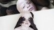 Photo Series Raise Awareness About Albinos