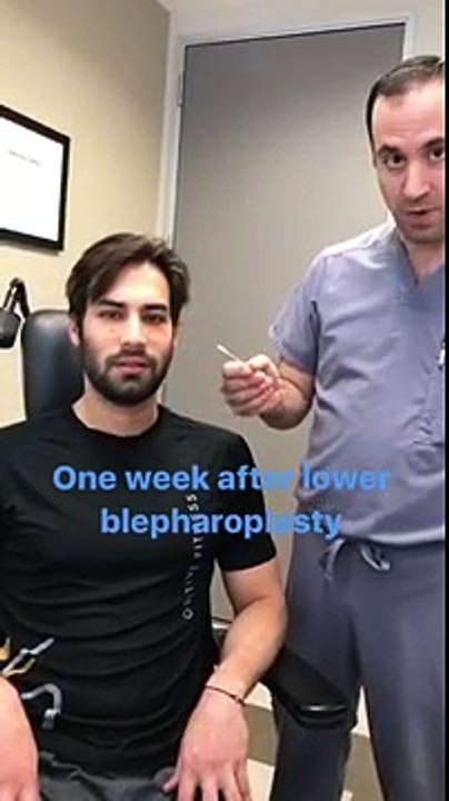 Excellent Cosmetic Eyelid Surgery - Blepharoplasty