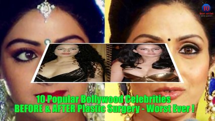 10 Popular Bollywood Celebrities BEFORE & AFTER Plastic Surgery   Worst Ever !