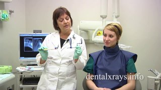 How to take dental x-rays when the patient has a narrow palate