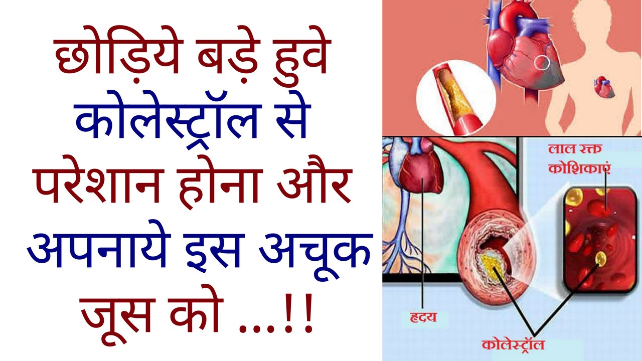 छोड़िये बड़े हुवे कोलेस्ट्रॉल से परेशान होना और अपनाये इस अचूक जूस को ...!!  Cholesterol Kam Karne Ke Upay in hindi