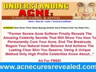 What Causes Acne