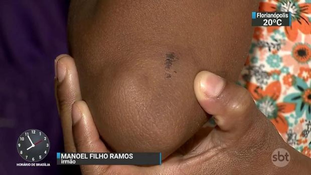 Menina atropelada ao descer da van escolar tem ferimentos leves