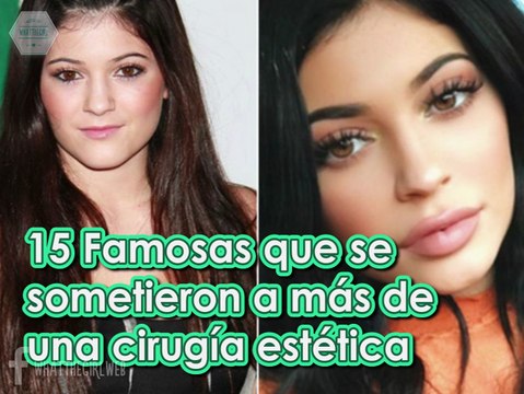 15 FAMOSAS QUE SE SOMETIERON A CIRUGÍA ESTÉTICA
