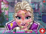 Elsa y Rapunzel médico de la piel (Elsa and Rapunzel Skin Doctor) - Juegos de Doctor