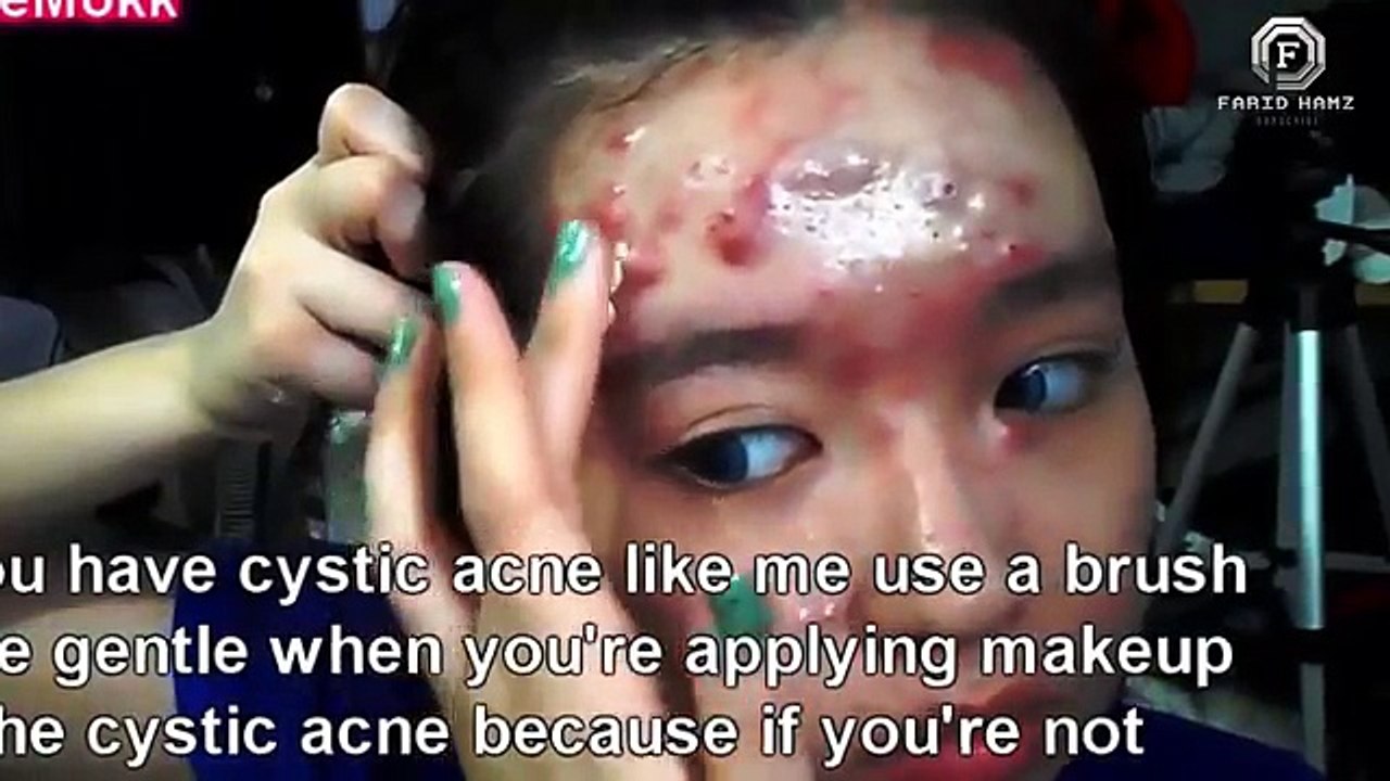 Ajaib ! Cara Tutupi Jerawat Parah Banget hanya dengan Makeup | FULL VIDEO