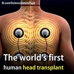the world's first human heart transplant