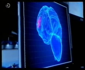 Lobulos frontales: La predisposicion al optimismo (Talli Sharot)