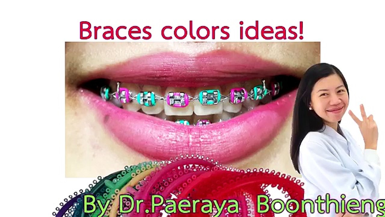 cute braces colors combinations for girls