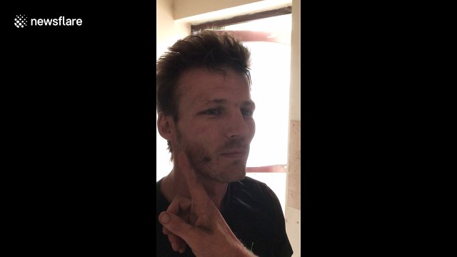 Huge spider crawls out from man's mouth