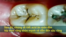 Quá trình hình thành, phát triển và “gây rối” của sâu răng