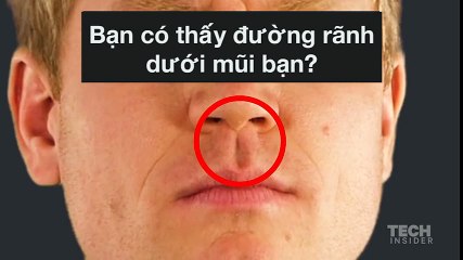 đây là lý do tại sao chúng ta có nhân trung