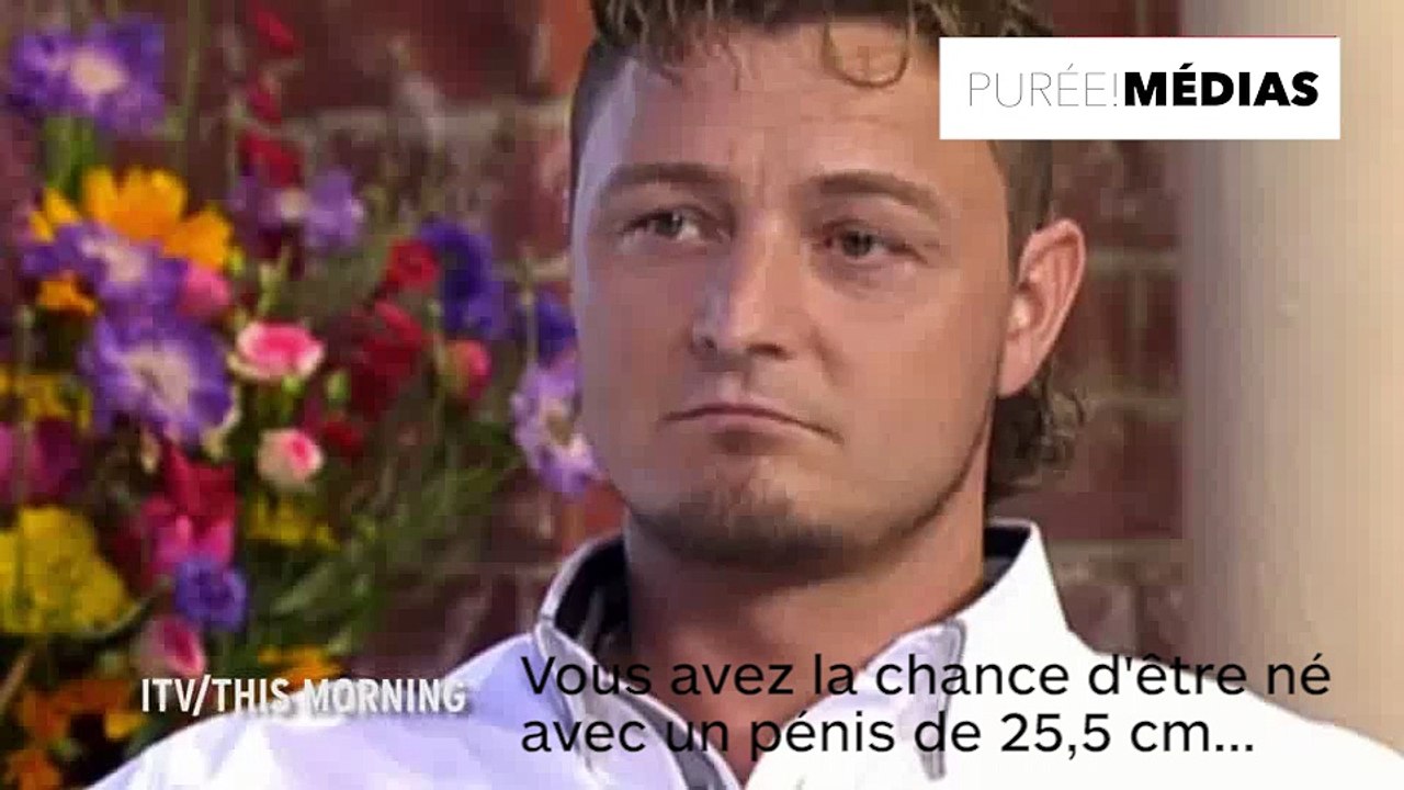 Il voulait que son pénis ressemble à un monstre : il le fait agrandir