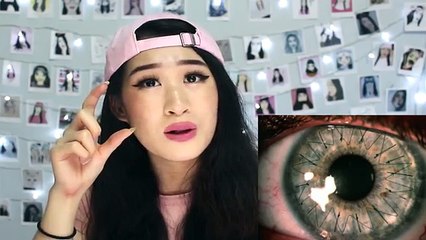 Try Not To Cringe At These Photos!!