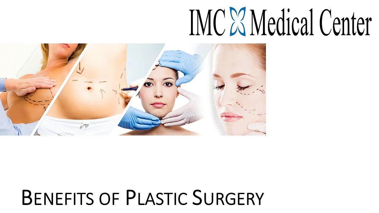 Benefits of Plastic Surgery