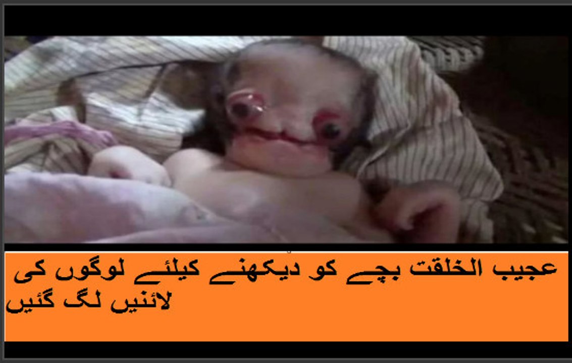عجیب الخلقت بچے کو دیکھنے کیلئے لوگوں کی لائنیں لگ گئیں