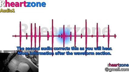 Rhz010 Rheartzone - Reconnect (abnormal female heart audio)