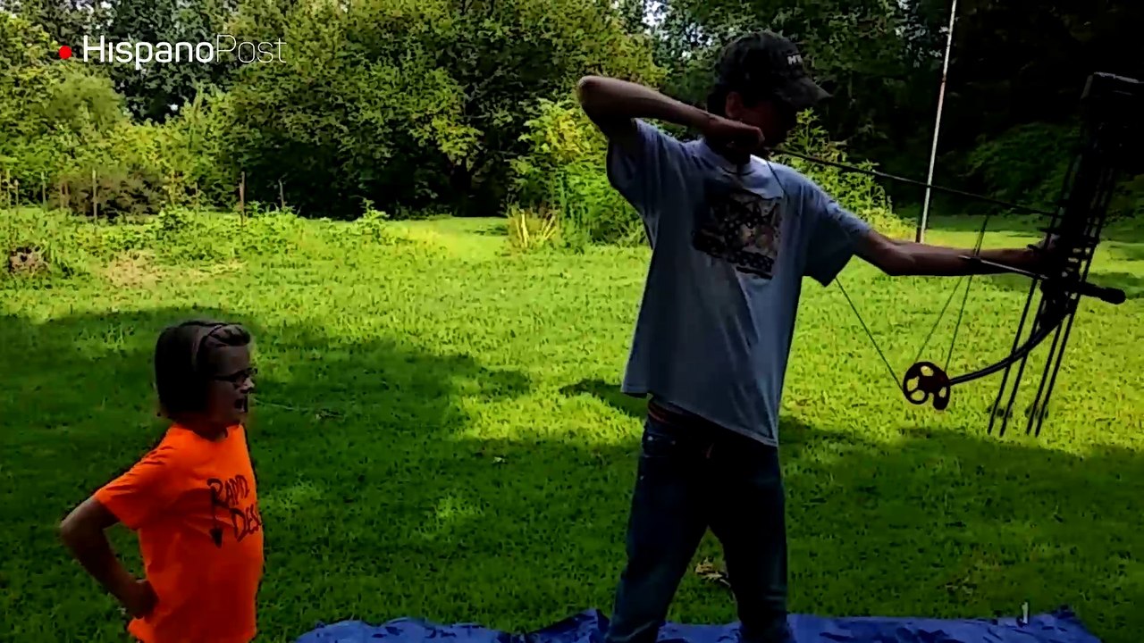 Su papá le sacó el diente utilizando un arco y una flecha