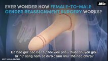 Phẫu thuật chuyển giới từ nữ sang nam sẽ được làm như thế nào?